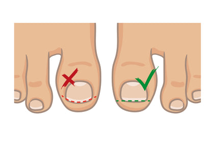 Lime pour ongles incarnés